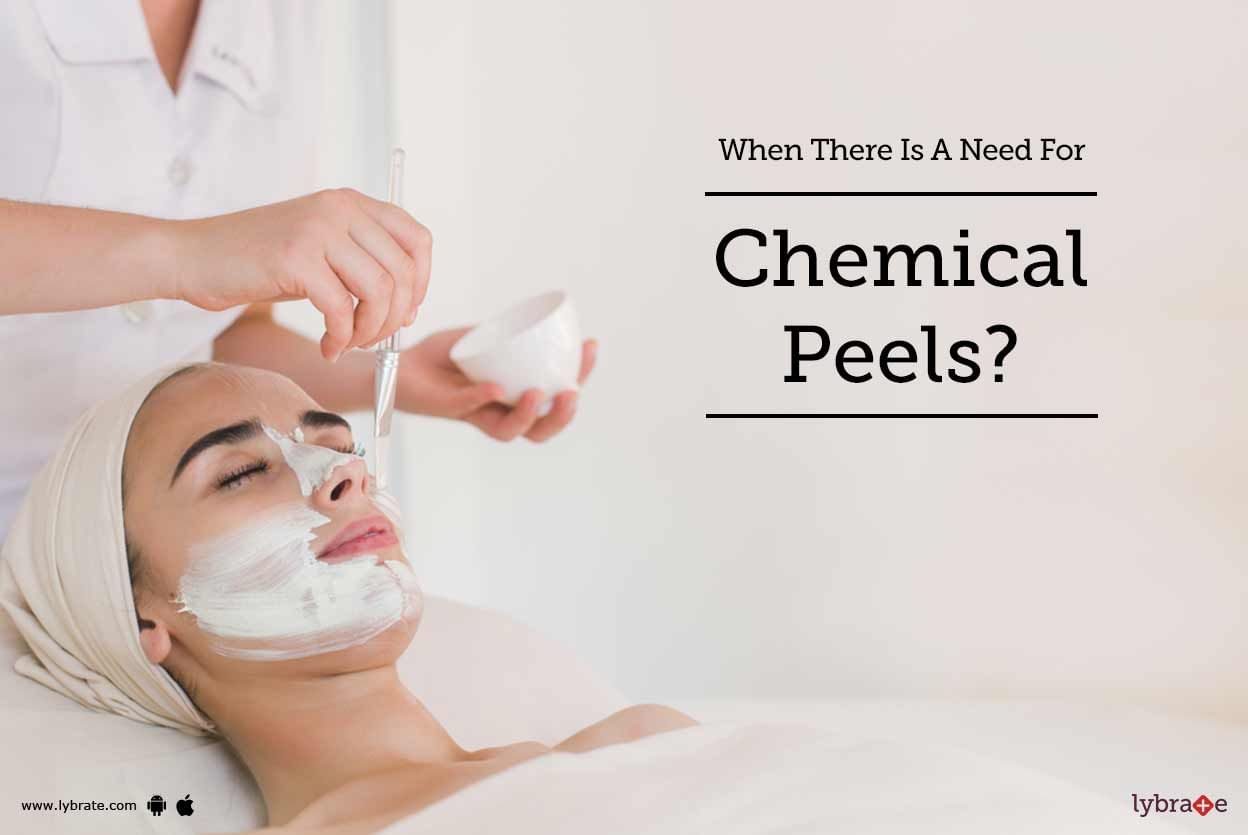 When There Is A Need For Chemical Peels?