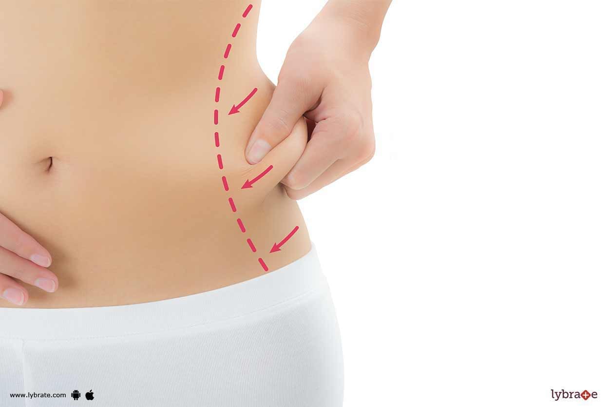 Liposuction For Removal Of Stubborn Fat Pockets!