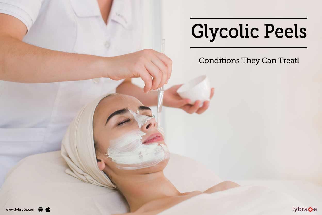 Glycolic Peels - Conditions They Can Treat!