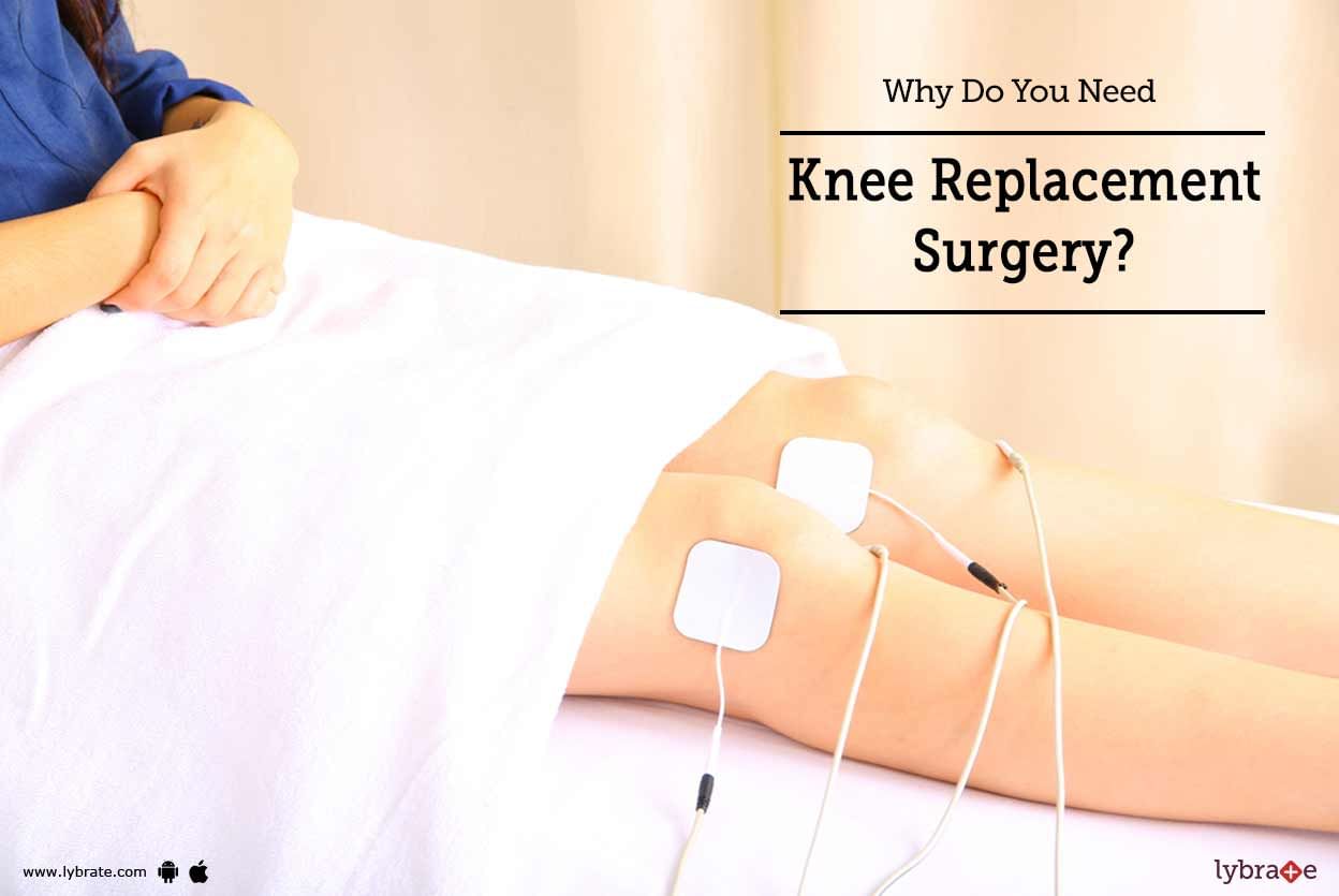 Why Do You Need Knee Replacement Surgery?