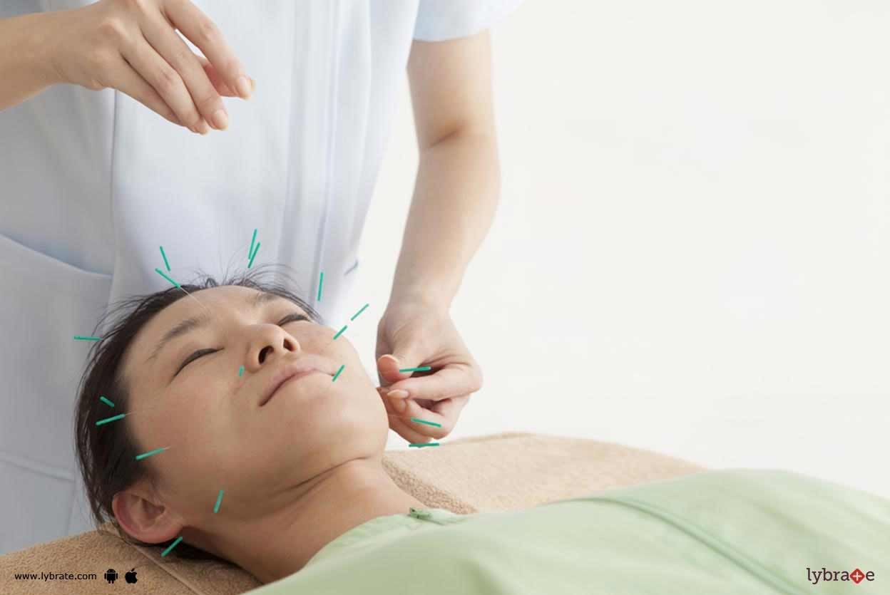 Stress & Anxiety - Can Acupuncture Be Of Help?
