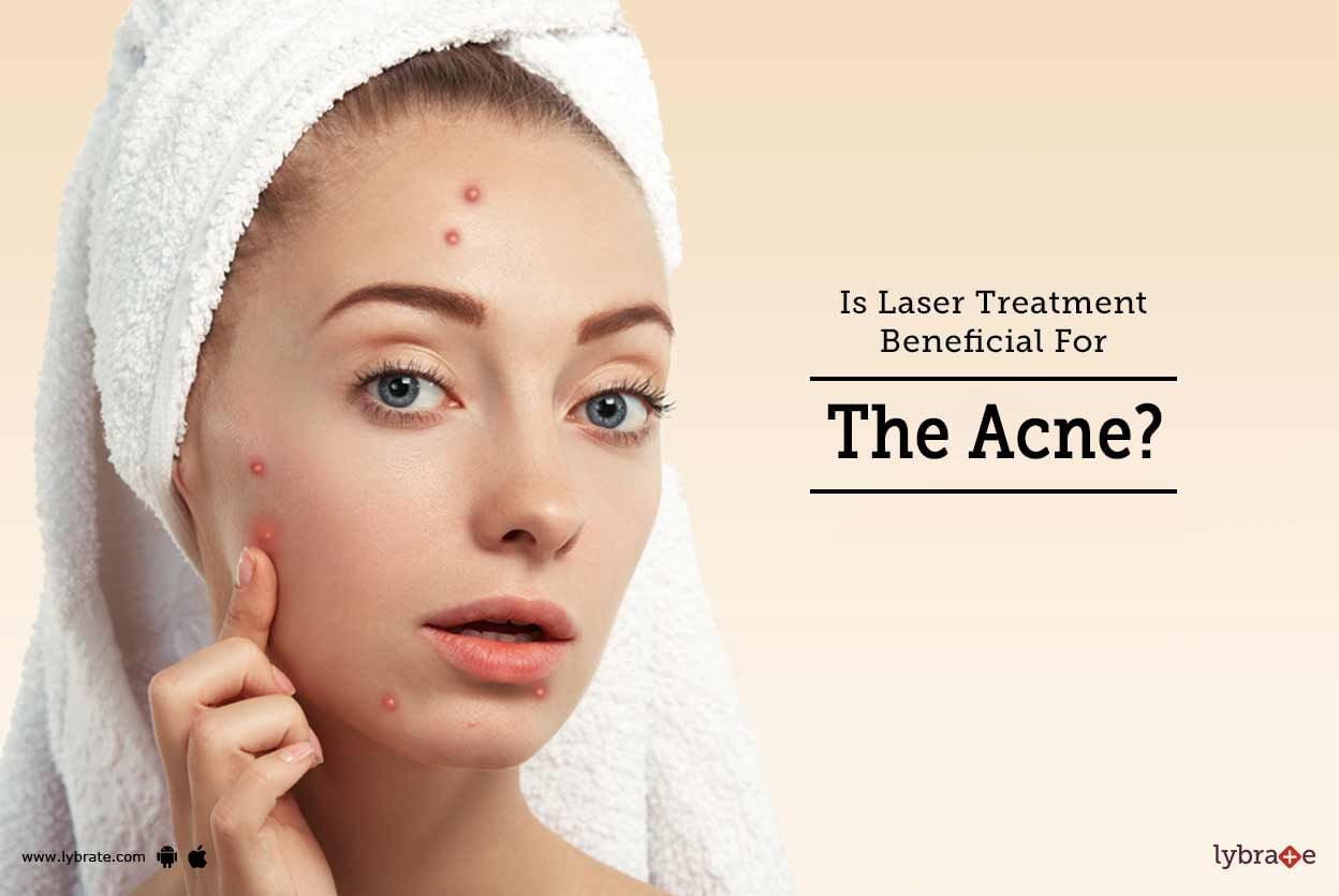 Is Laser Treatment Beneficial For The Acne?