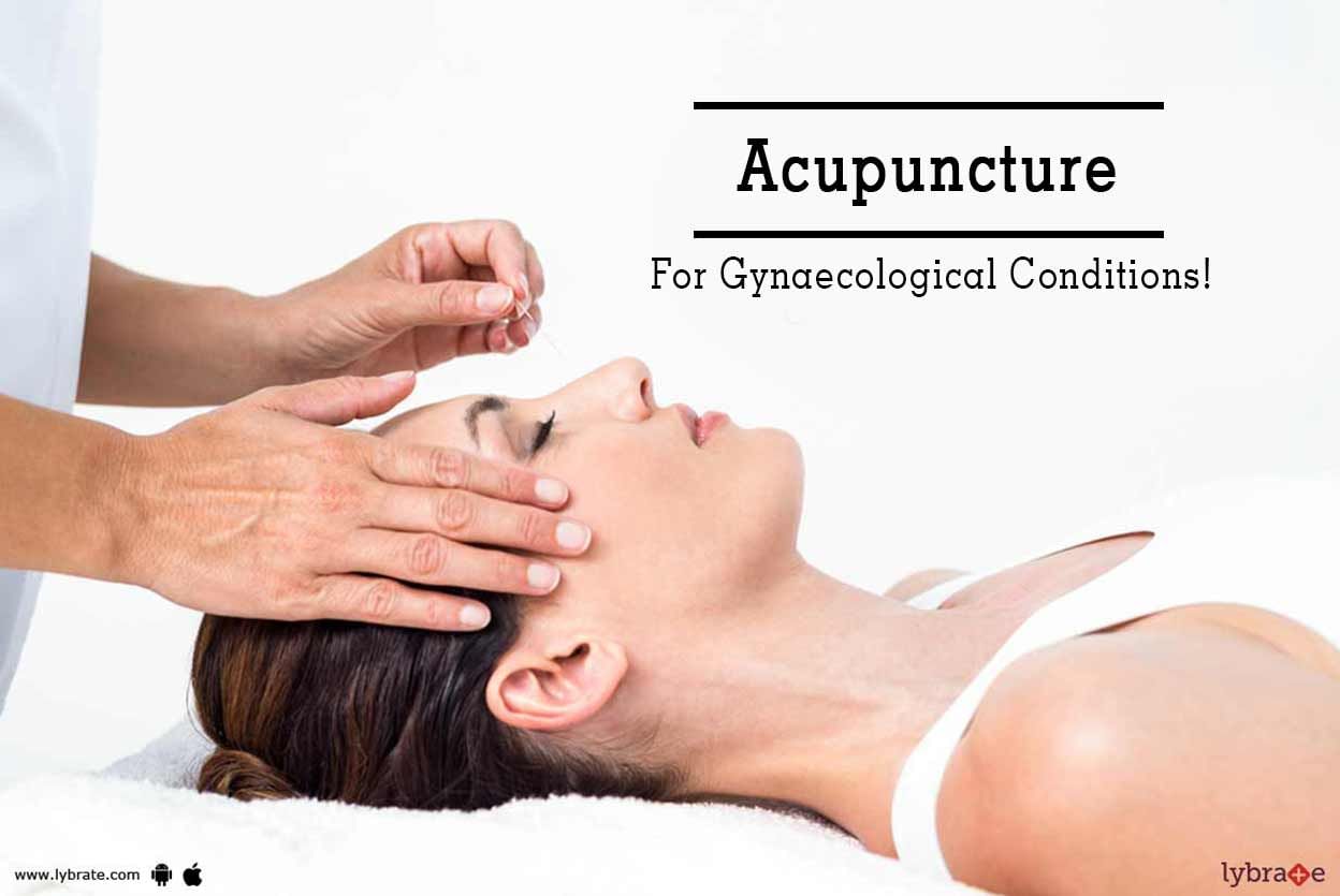 Acupuncture For Gynaecological Conditions!