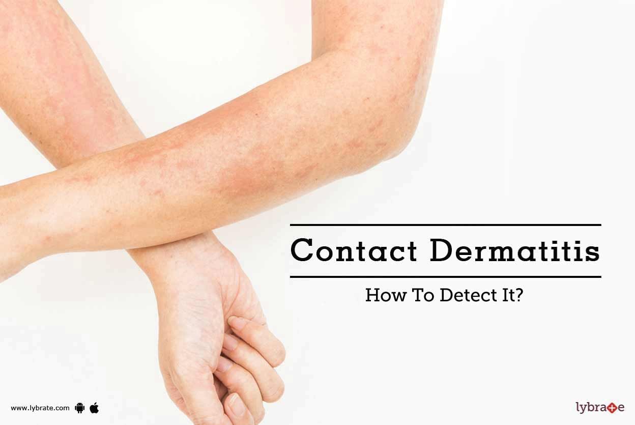 Contact Dermatitis - How To Detect It?