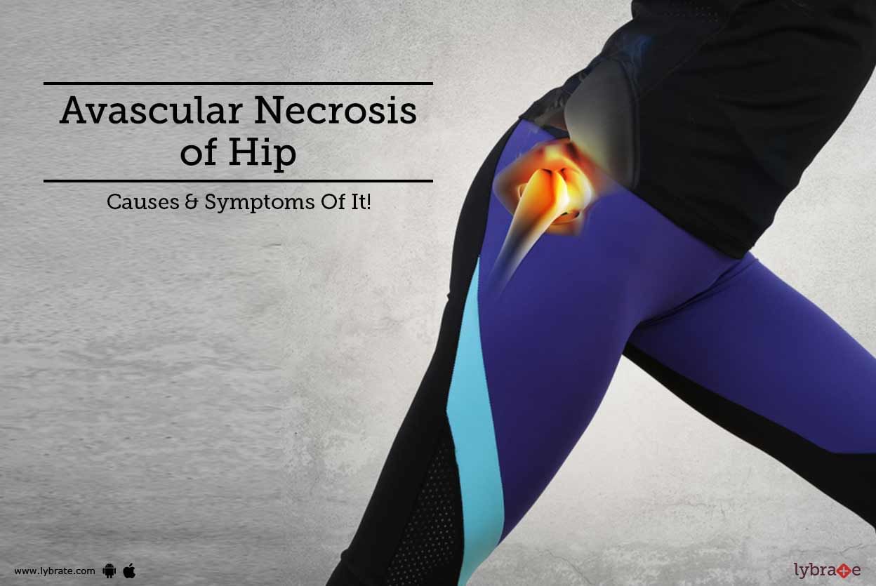 Avascular Necrosis Of Hip - Causes & Symptoms Of It!