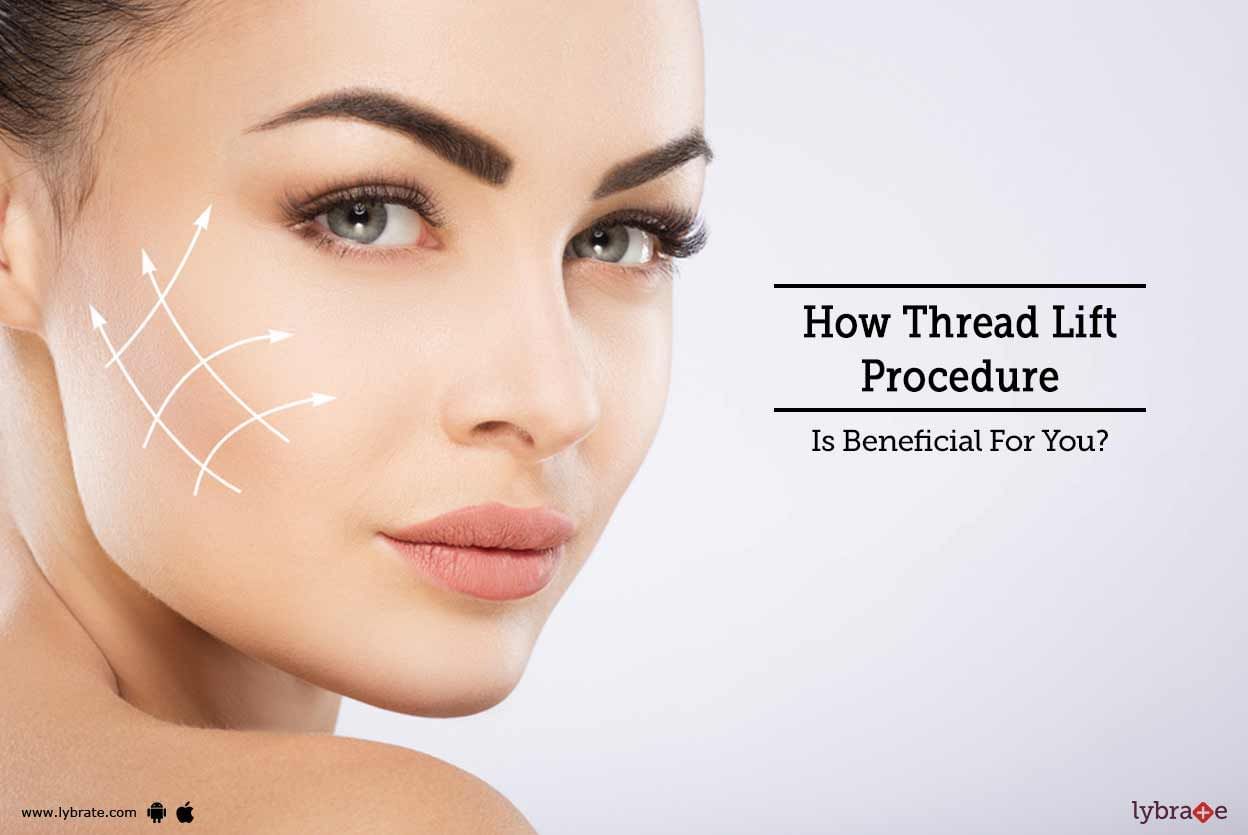 How Thread Lift Procedure Is Beneficial For You?