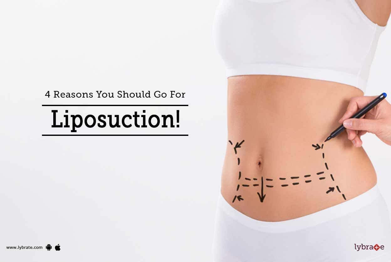 4 Reasons You Should Go For Liposuction!