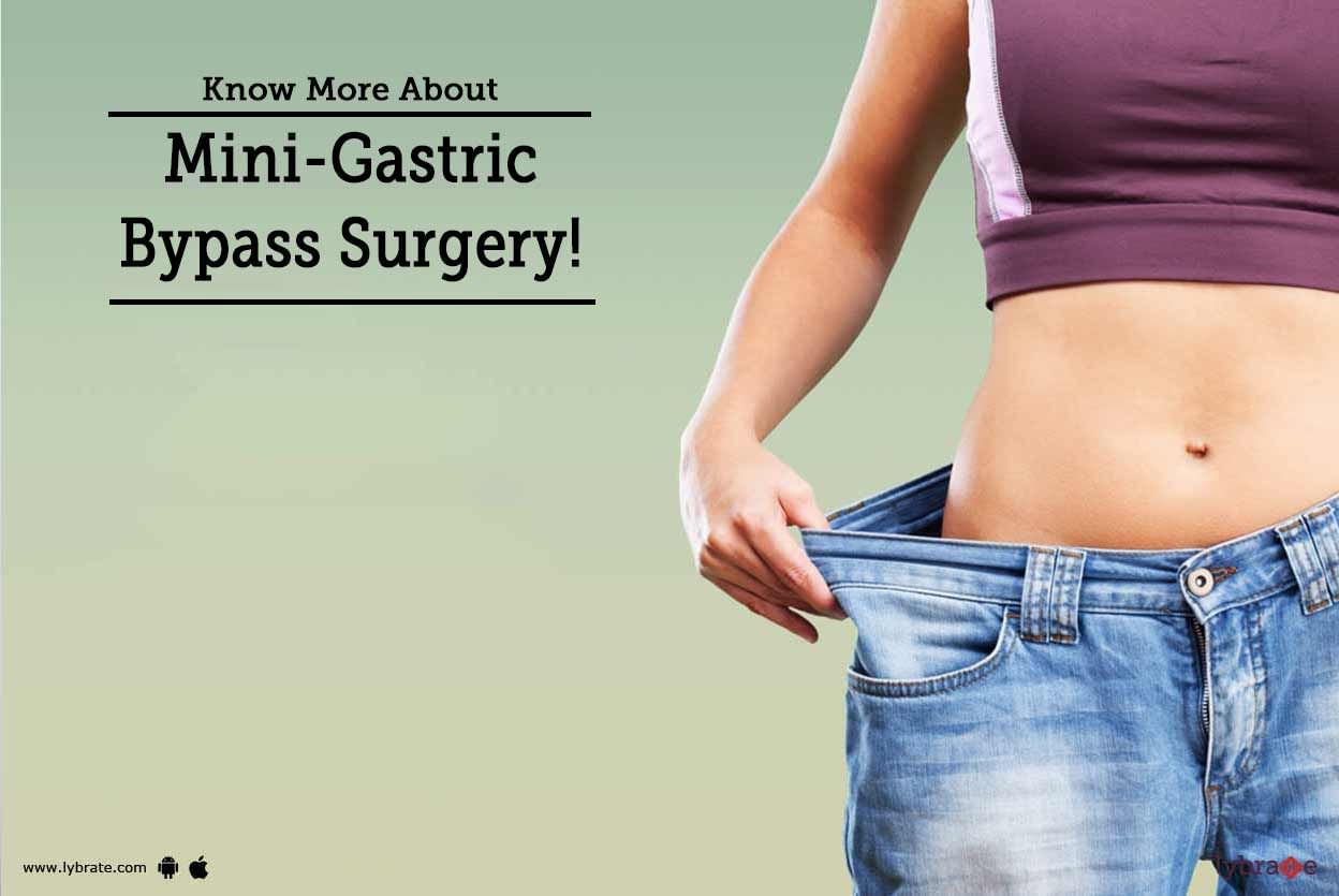 Know More About Mini-Gastric Bypass Surgery!