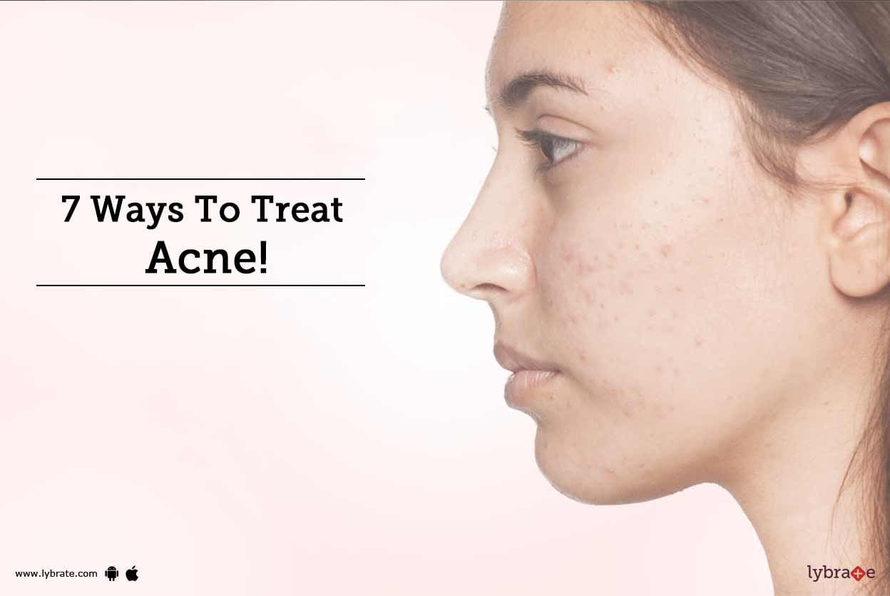 7 Ways To Treat Acne!