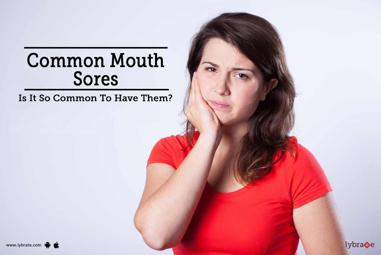 Common Mouth Sores - Is It So Common To Have Them?
