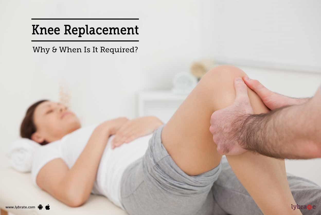 Knee Replacement - Why & When Is It Required?