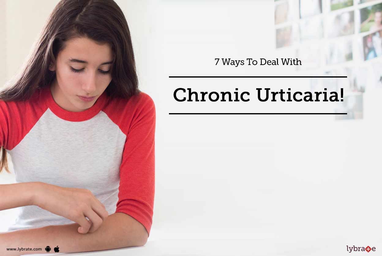 7 Ways To Deal With Chronic Urticaria!
