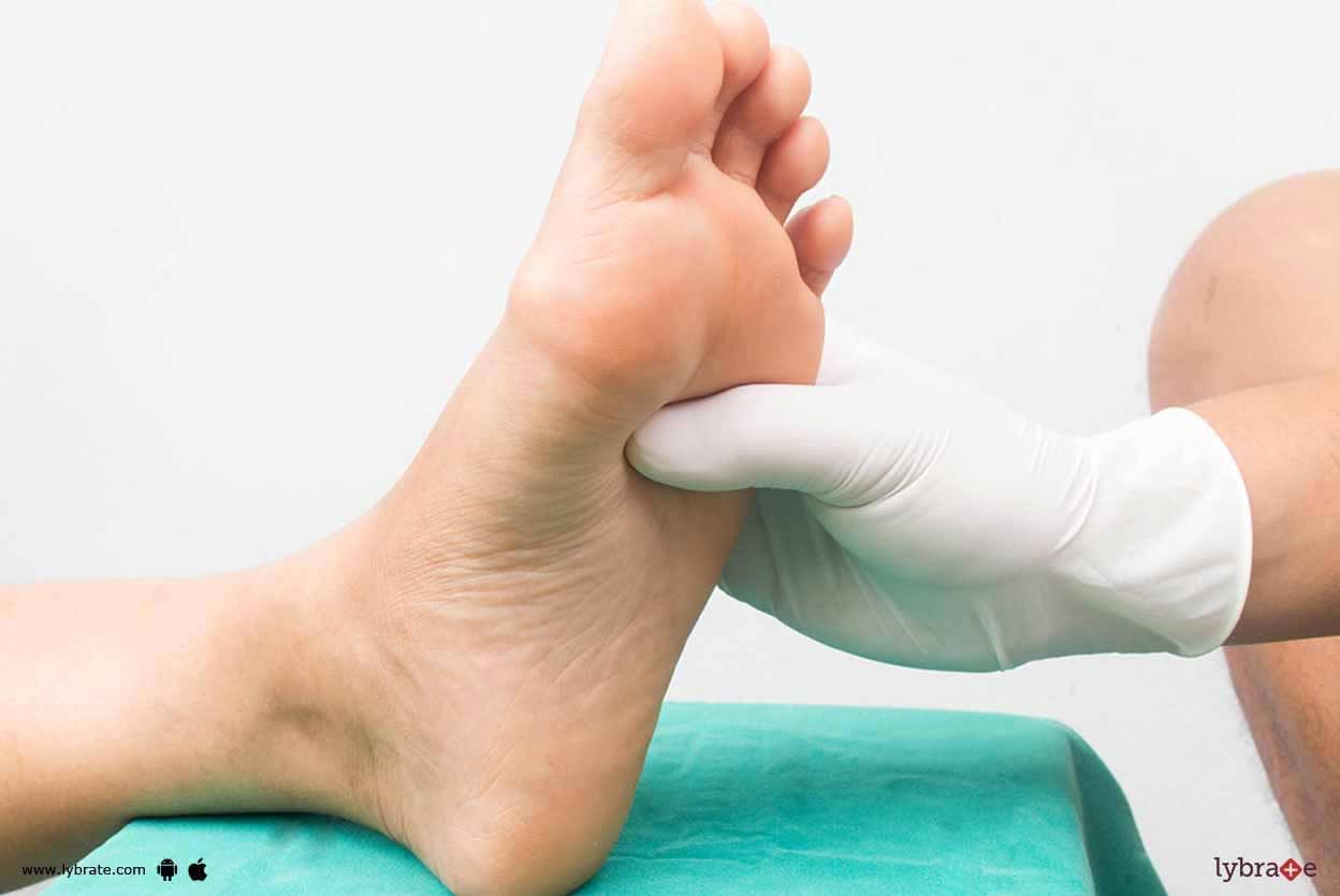 Foot Arch Pain - How To Manage It?