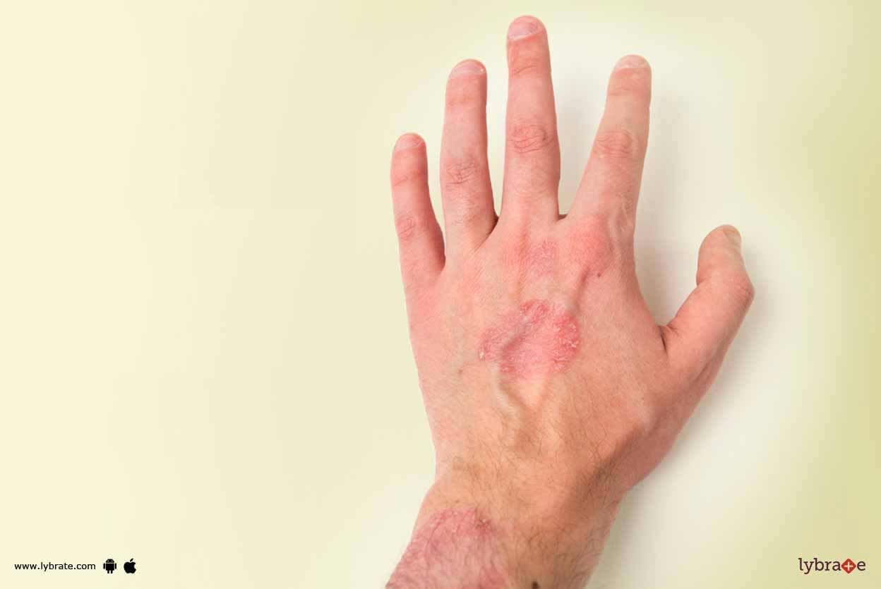 Degloving Injuries - How To Get Rid Of Them?