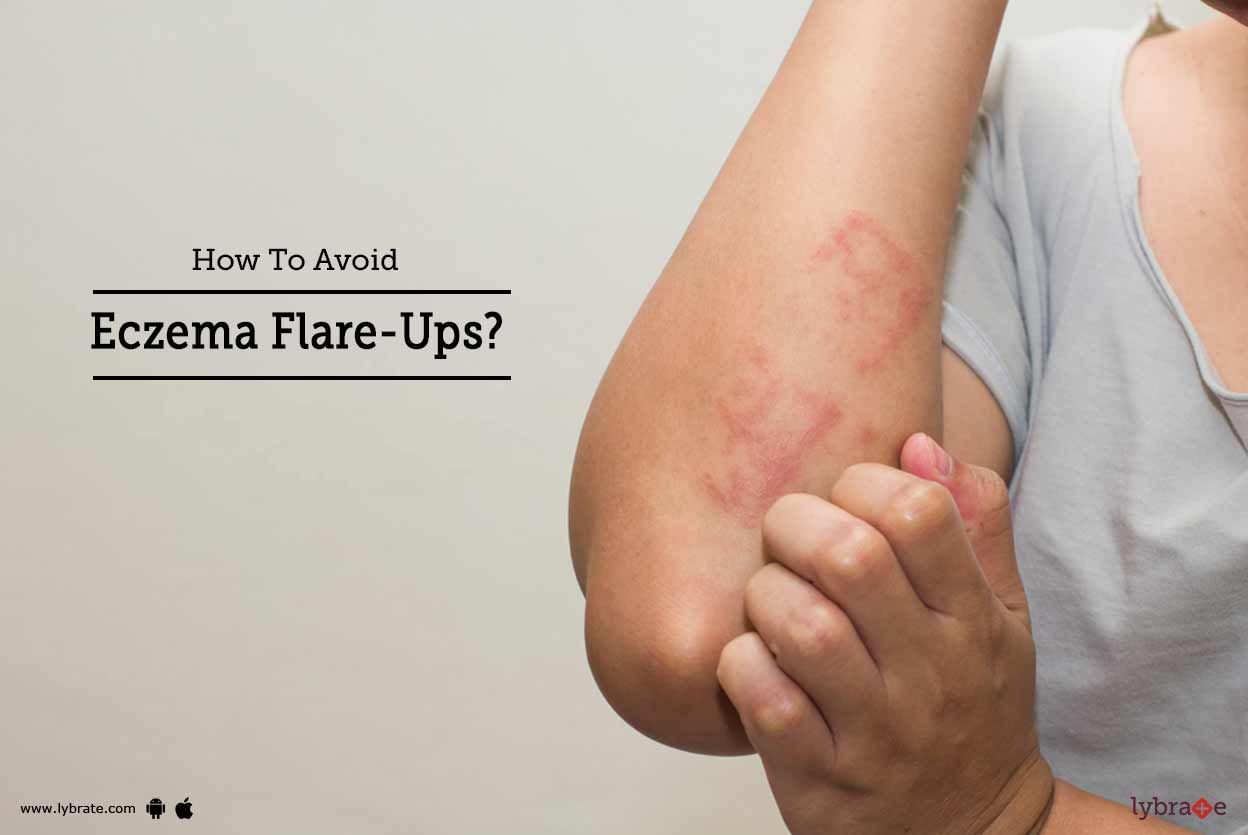 How To Avoid Eczema Flare-Ups?