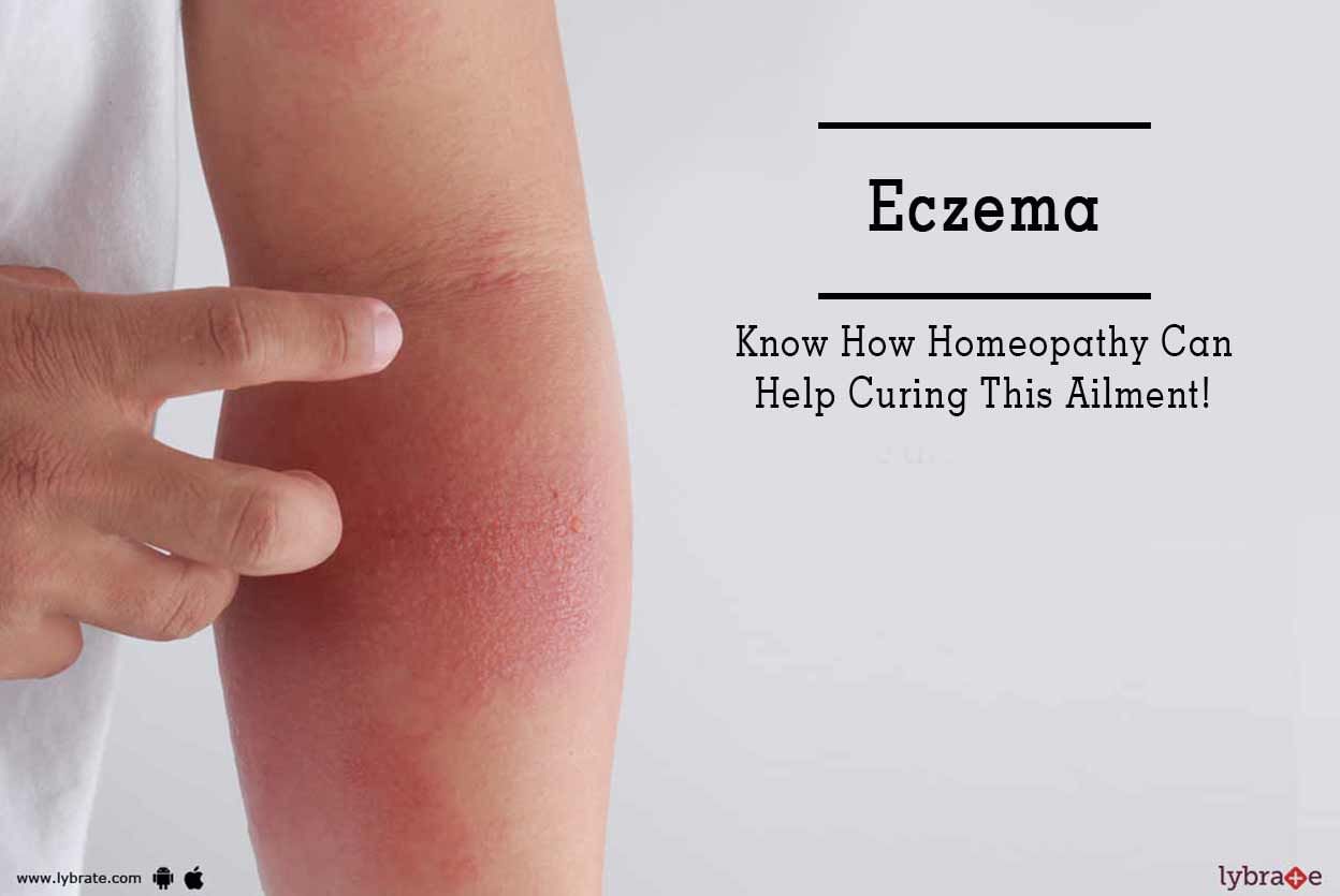 Eczema - Know How Homeopathy Can Help Curing This Ailment!