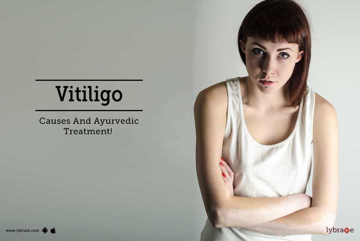 Vitiligo - Causes And Ayurvedic Treatment!