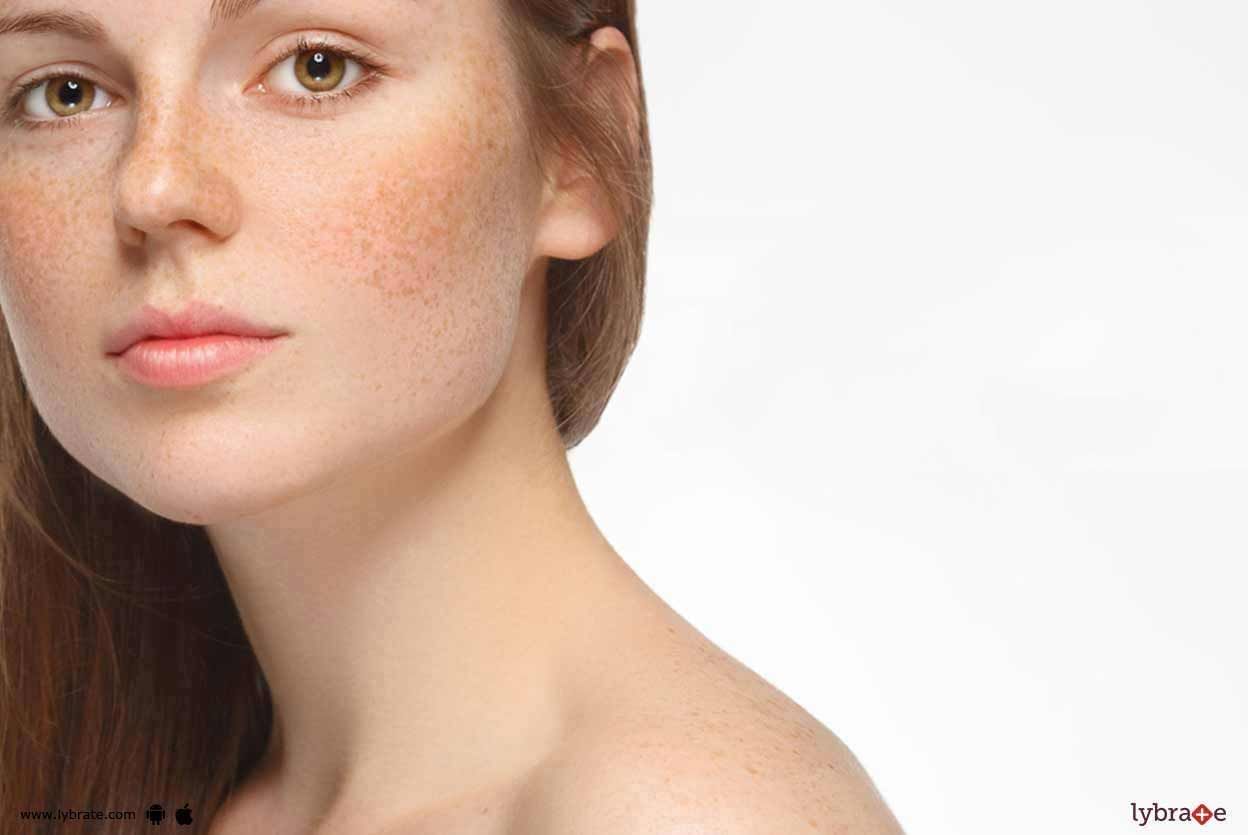 How To Manage Hyperpigmentation And Hypopigmentation?