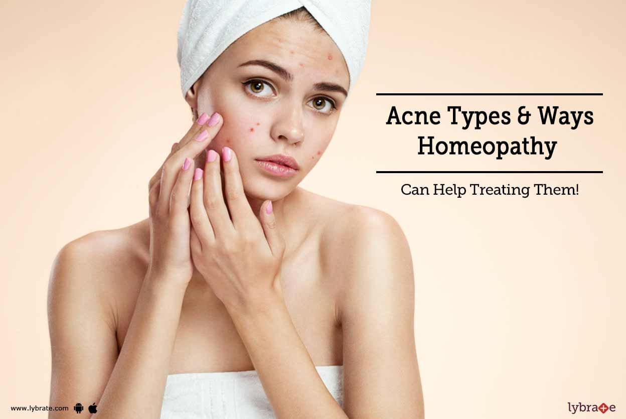 Acne Types & Ways Homeopathy Can Help Treating Them!