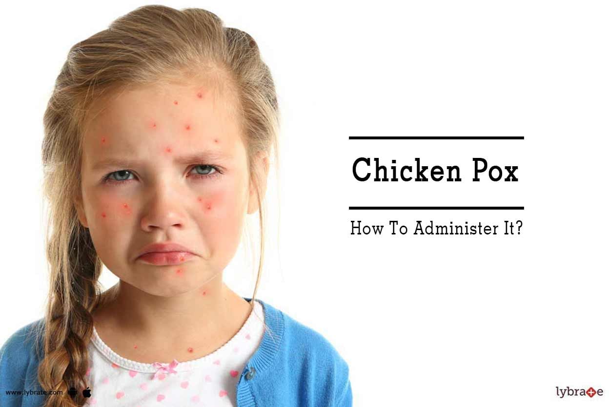 Chicken Pox - How To Administer It?