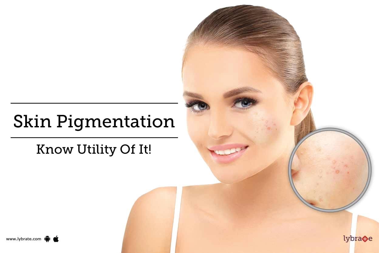 Skin Pigmentation - Know Utility Of It!