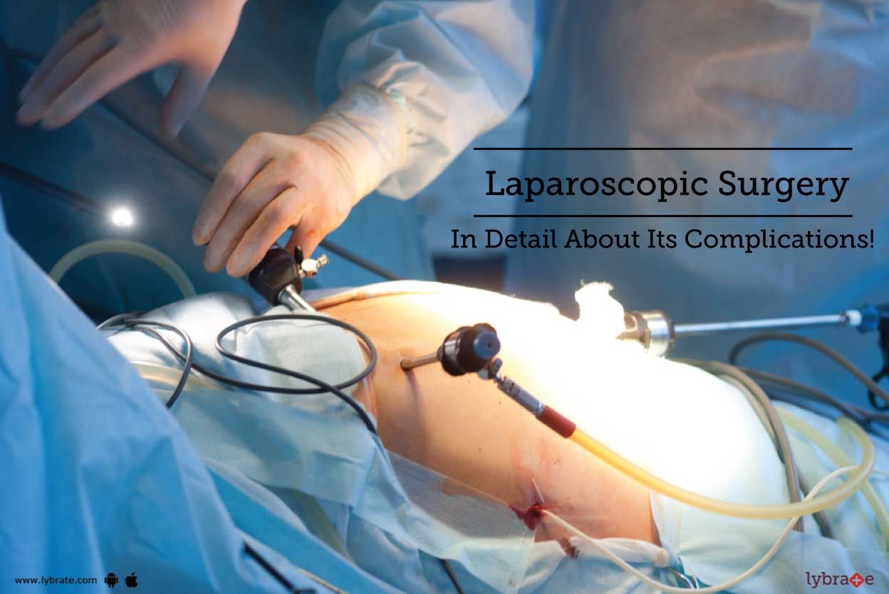 Laparoscopic Surgery - In Detail About Its Complications!