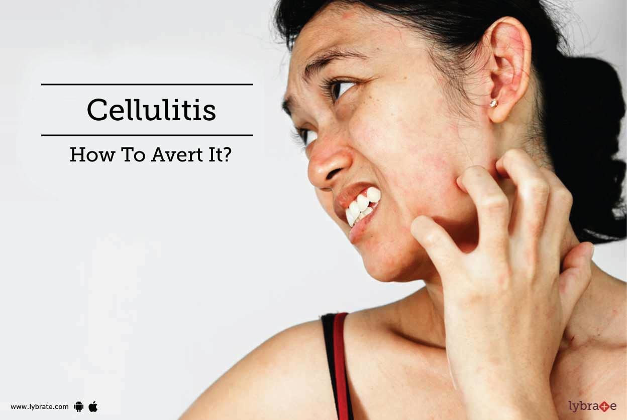 Cellulitis - How To Avert It?