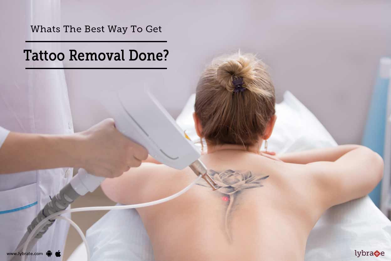 Whats The Best Way To Get Tattoo Removal Done?