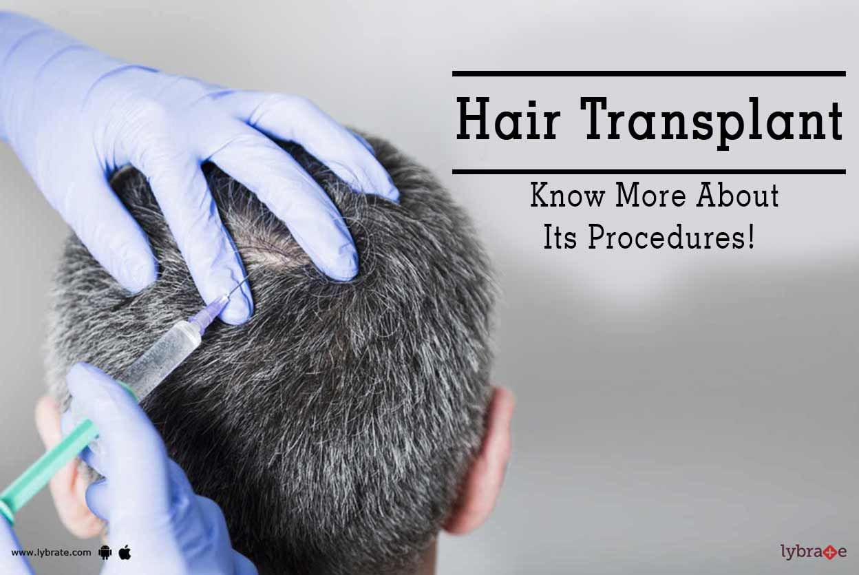 Hair Transplant - Know More About Its Procedures!