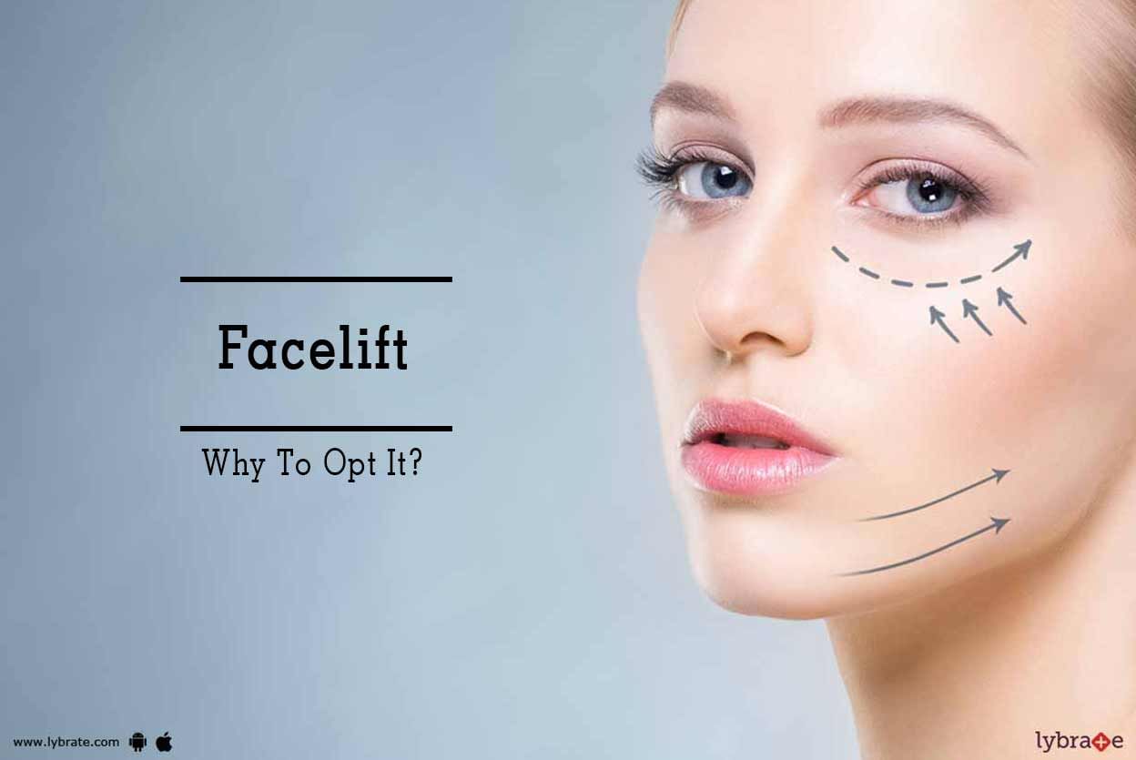 Facelift - Why To Opt It?
