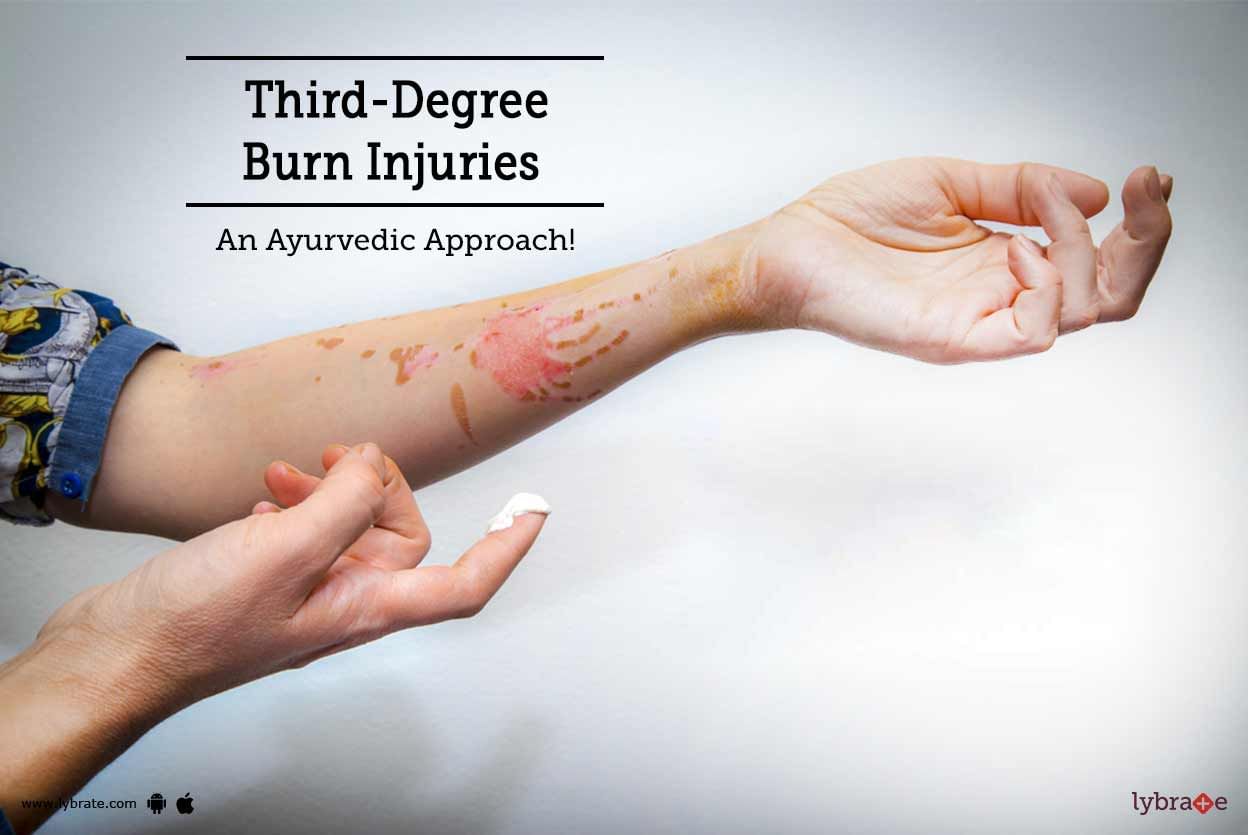 Third-Degree Burn Injuries - An Ayurvedic Approach!