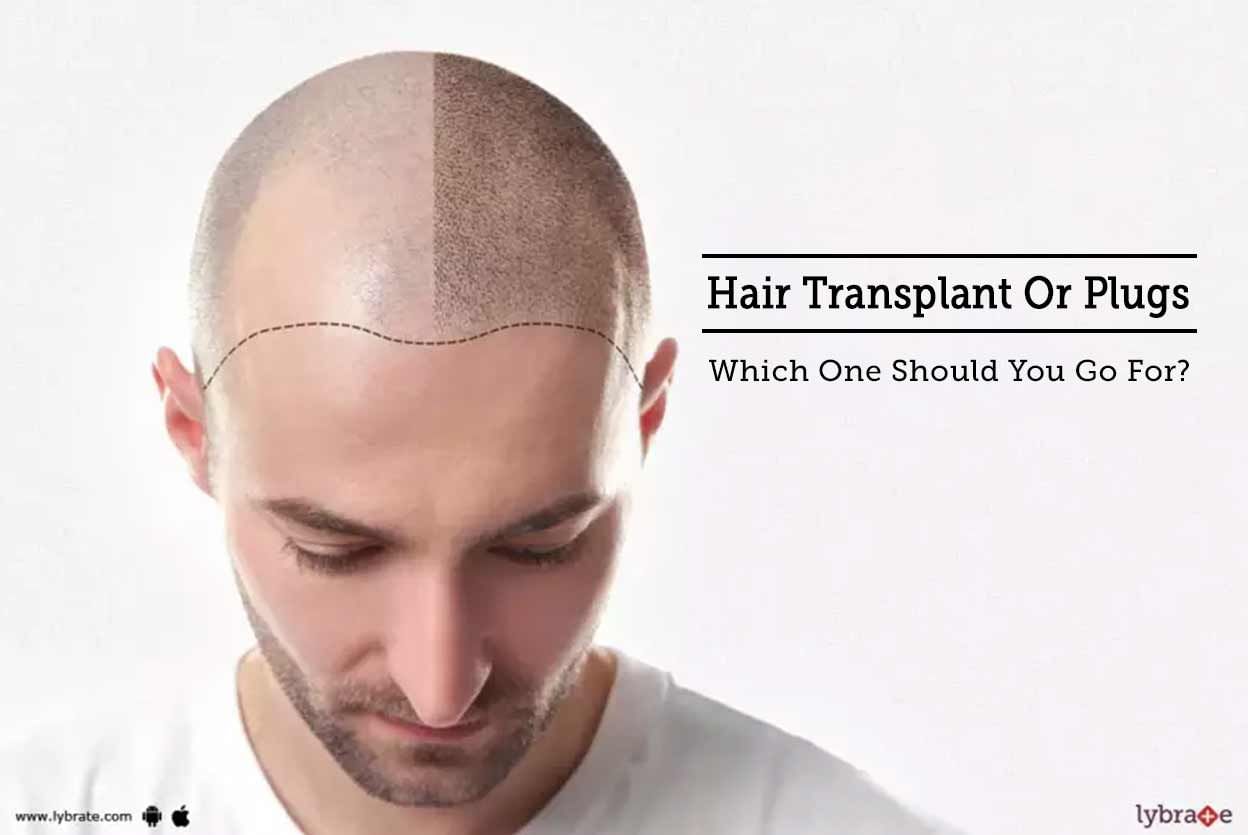 Hair Transplant Or Plugs - Which One Should You Go For?