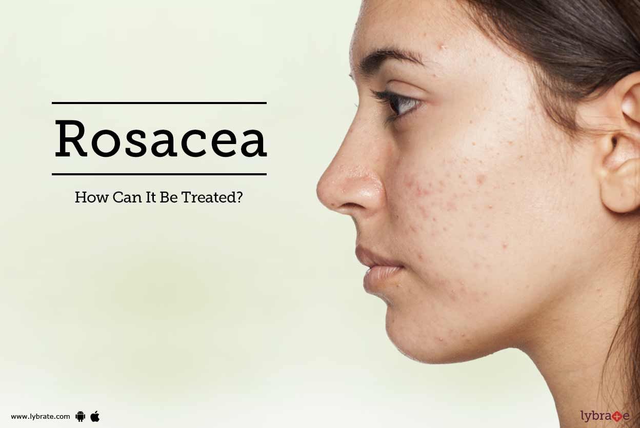 Rosacea - How Can It Be Treated?