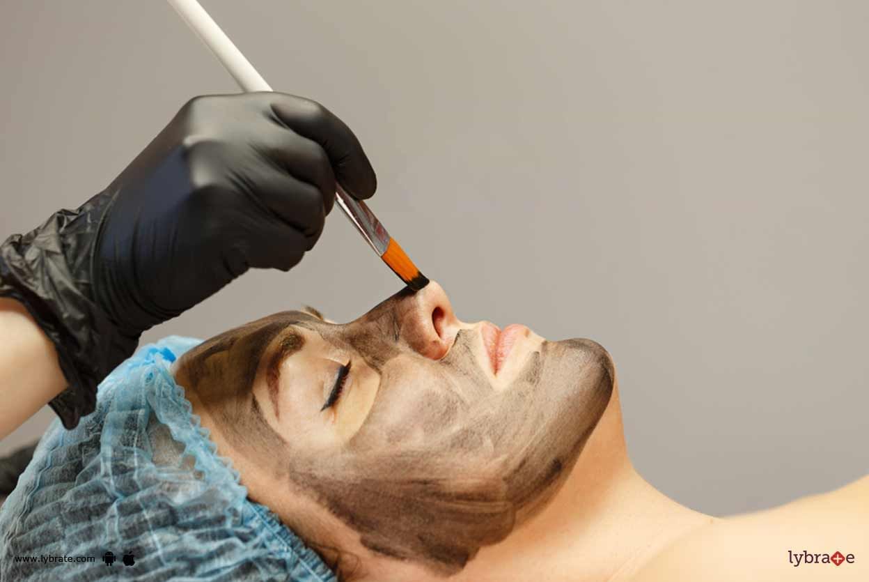 Carbon Facial - Learn About Its Benefits!