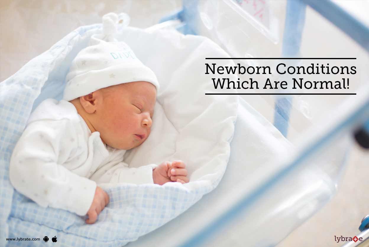 Newborn Conditions Which Are Normal!