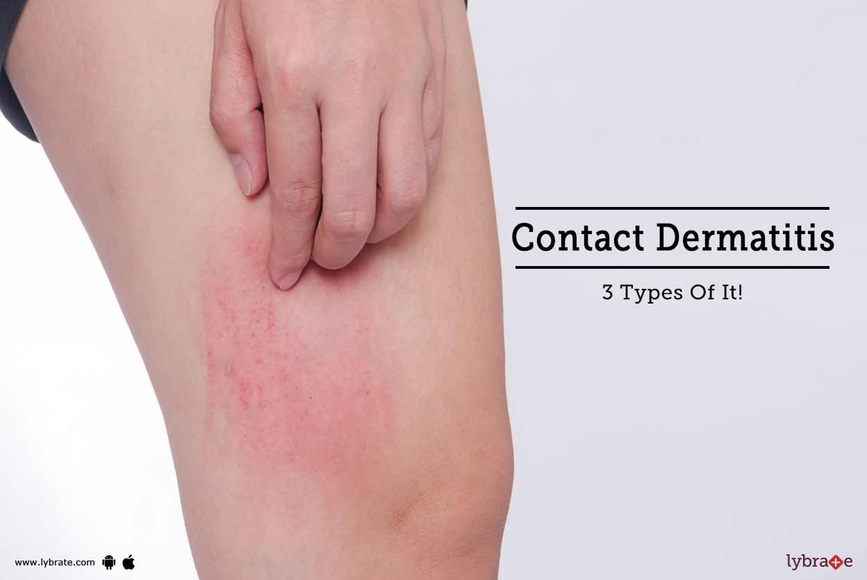 Contact Dermatitis - 3 Types Of It!