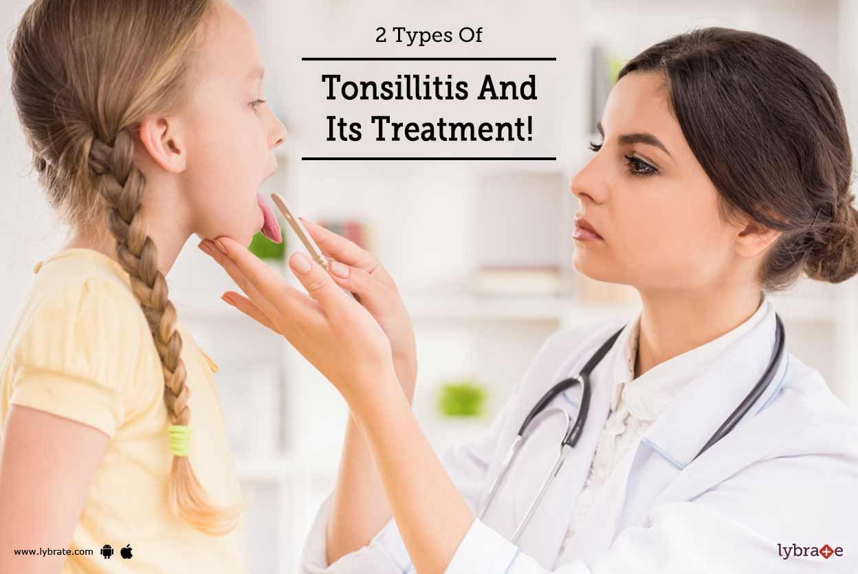 2 Types Of Tonsillitis And Its Treatment!