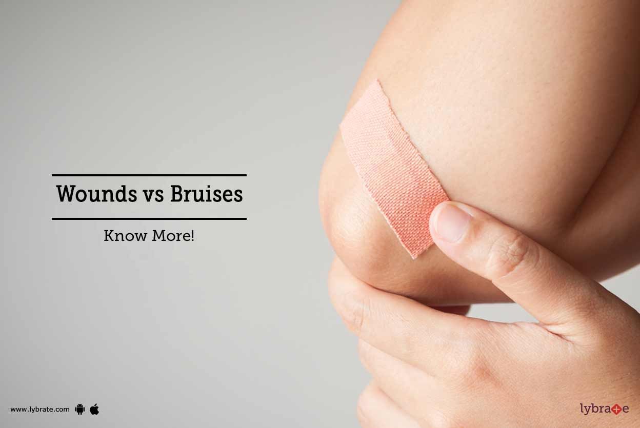 Wounds vs Bruises - Know More!
