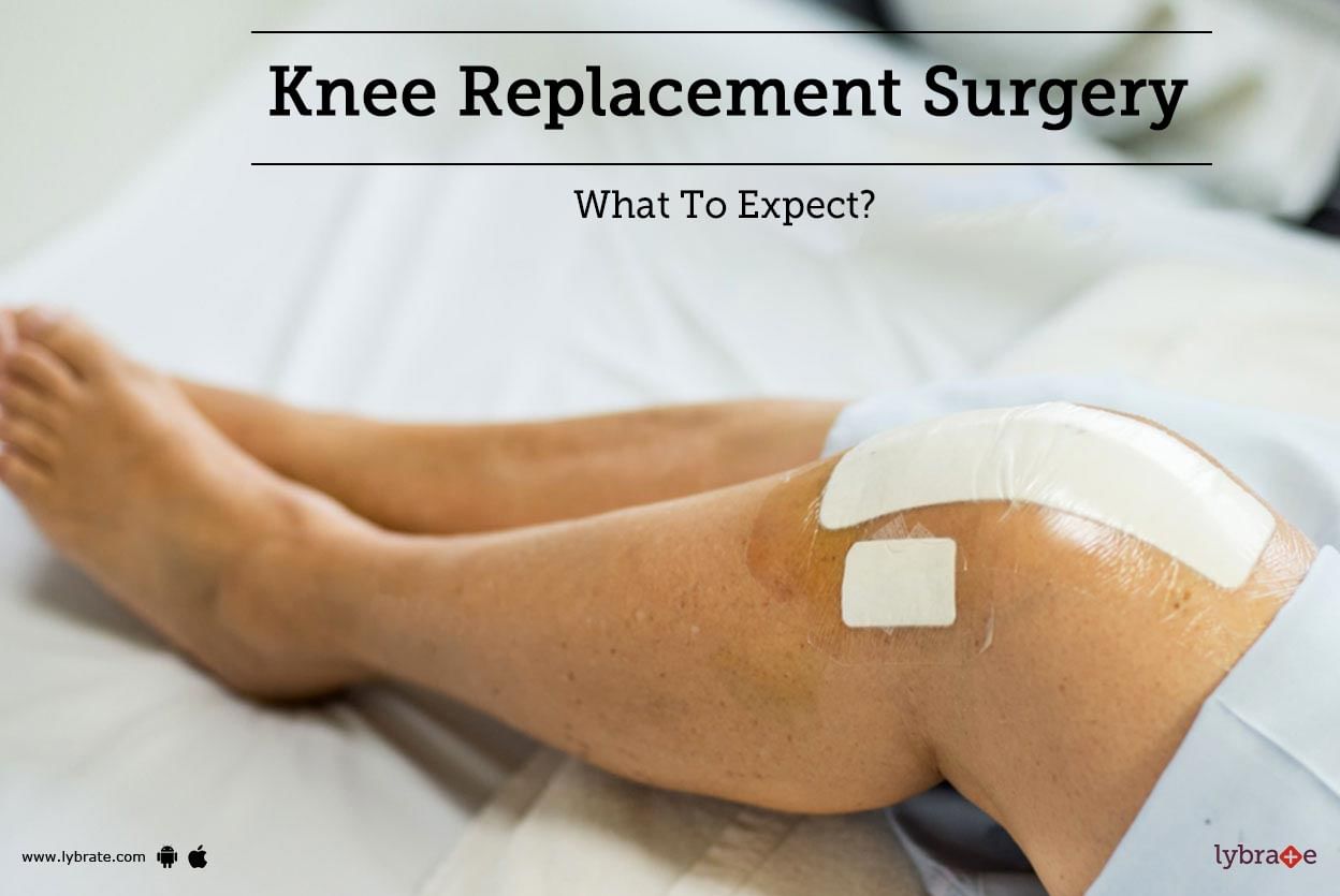 Knee Replacement Surgery - What To Expect?
