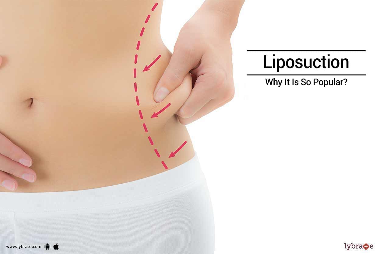 Liposuction - Why It Is So Popular?
