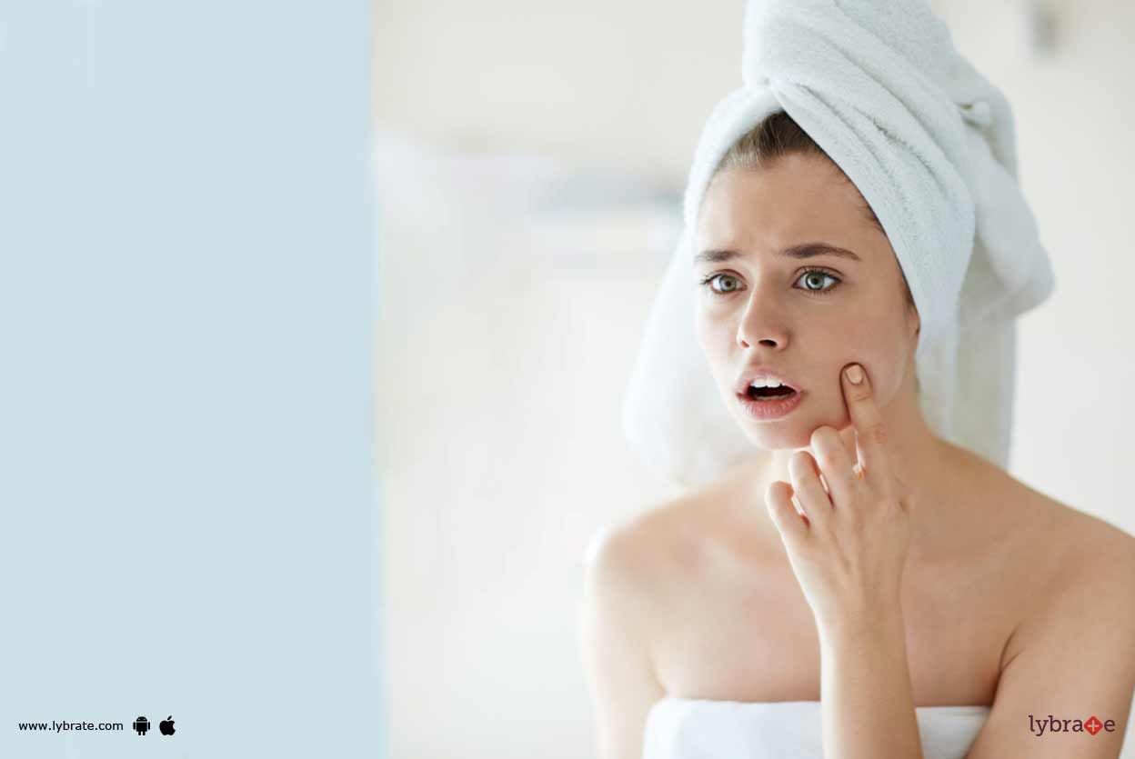 Acne - How Can Panchkarma Help You Out?