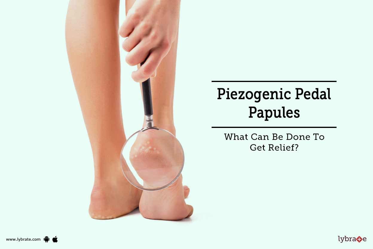 Piezogenic Pedal Papules - What Can Be Done To Get Relief?