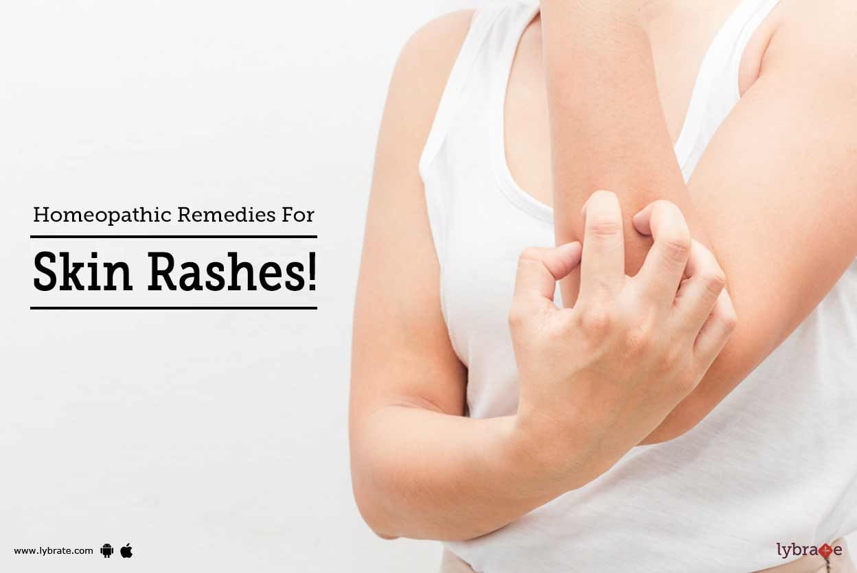 Homeopathic Remedies For Skin Rashes!