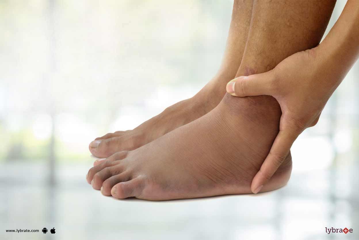 Fluid Retention - How Can It Impact Your Health?