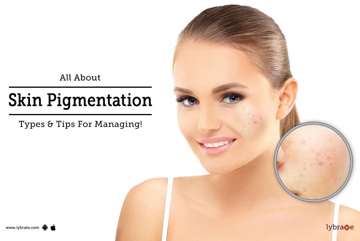All About Skin Pigmentation: Types & Tips For Managing!