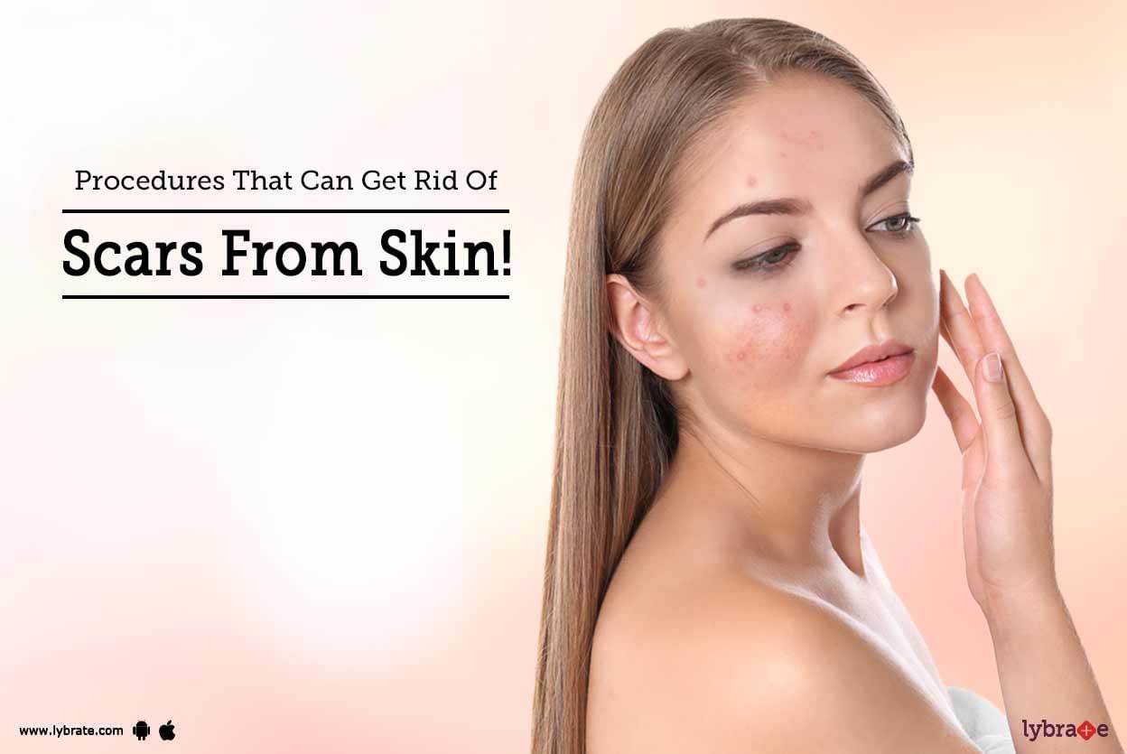 Procedures That Can Get Rid Of Scars From Skin!