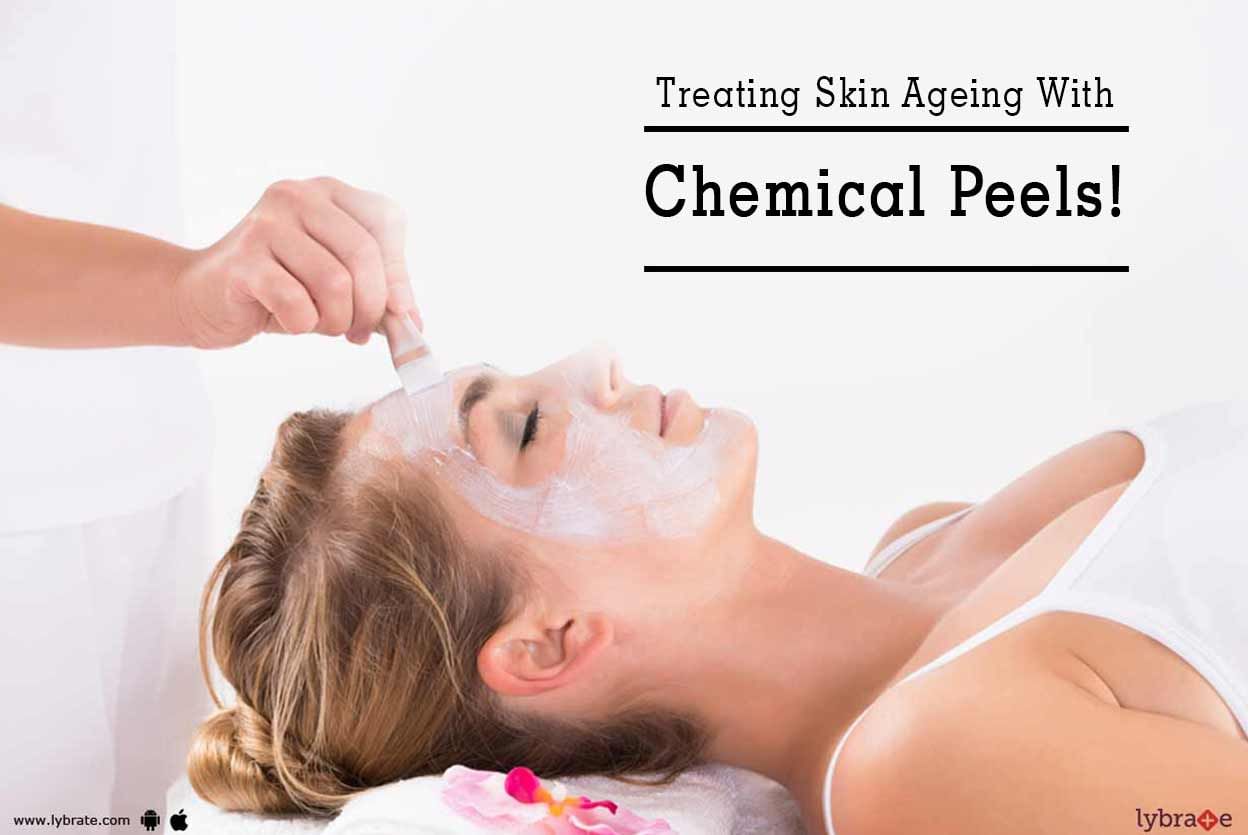 Treating Skin Ageing With Chemical Peels!
