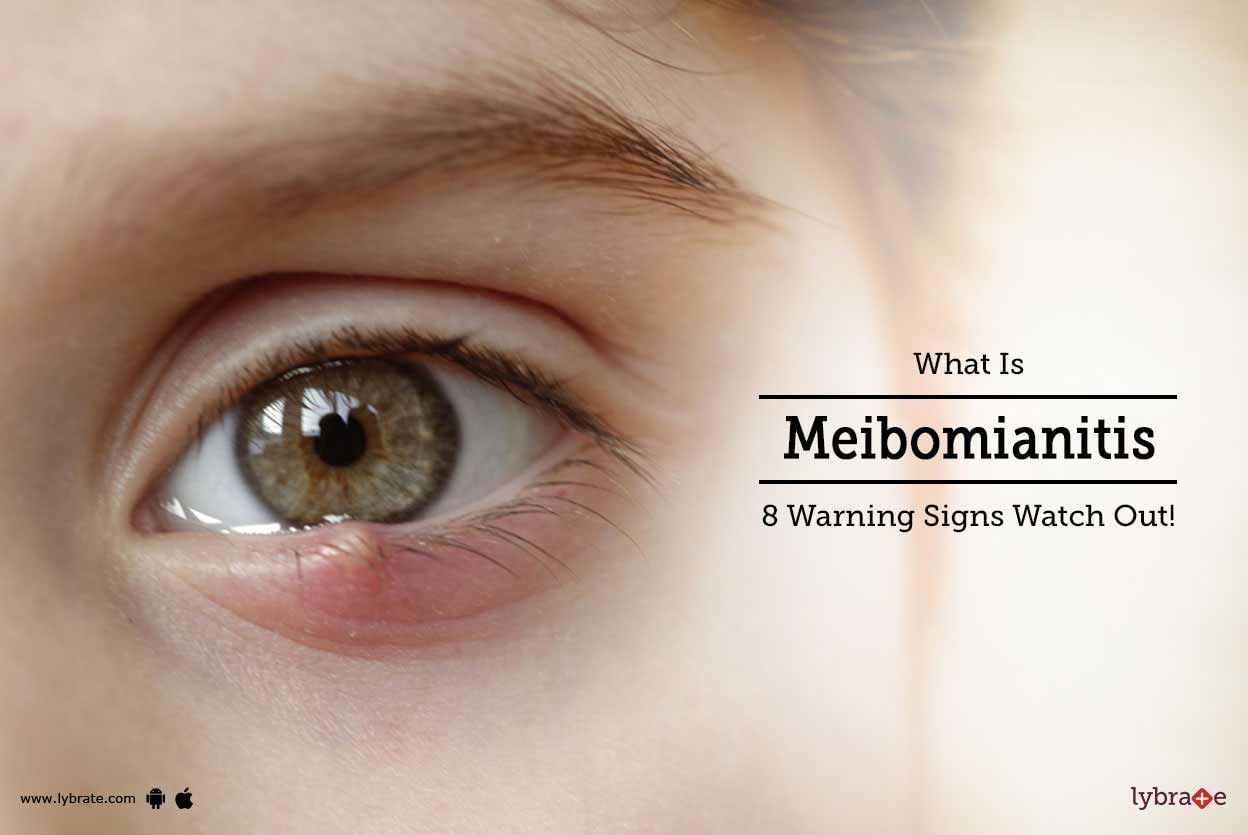 What Is Meibomianitis And How Can We Treat It?