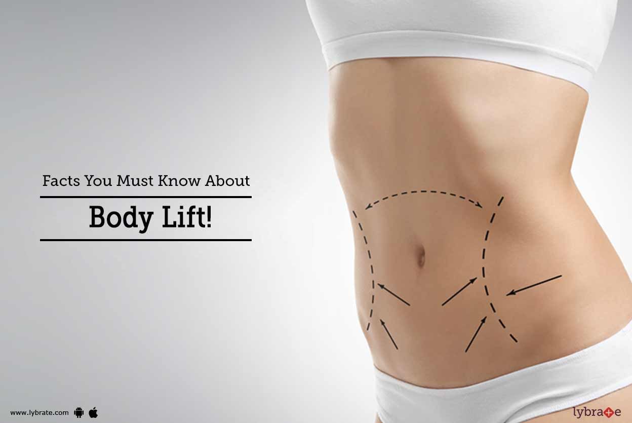 Facts You Must Know About Body Lift!