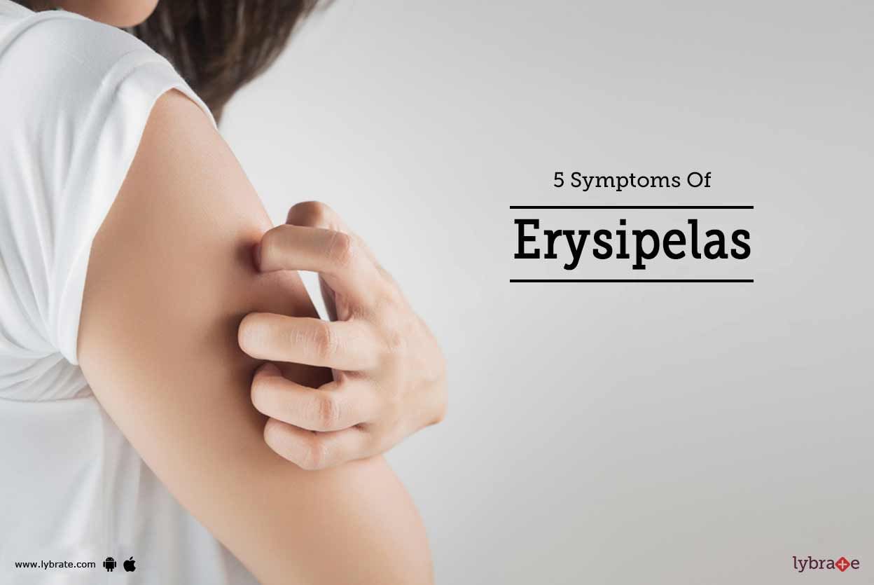 5 Symptoms Of Erysipelas